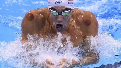 Cupping During Olympics